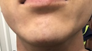 After